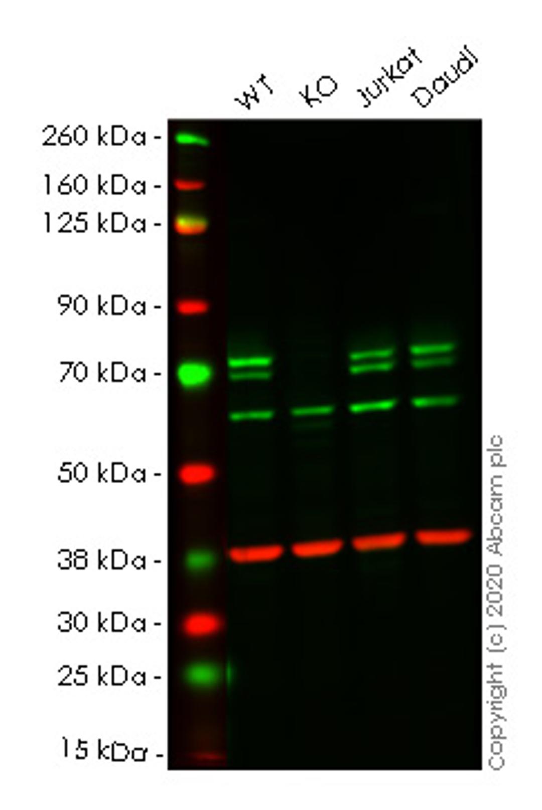 WB - ATG16L1 knockout HeLa