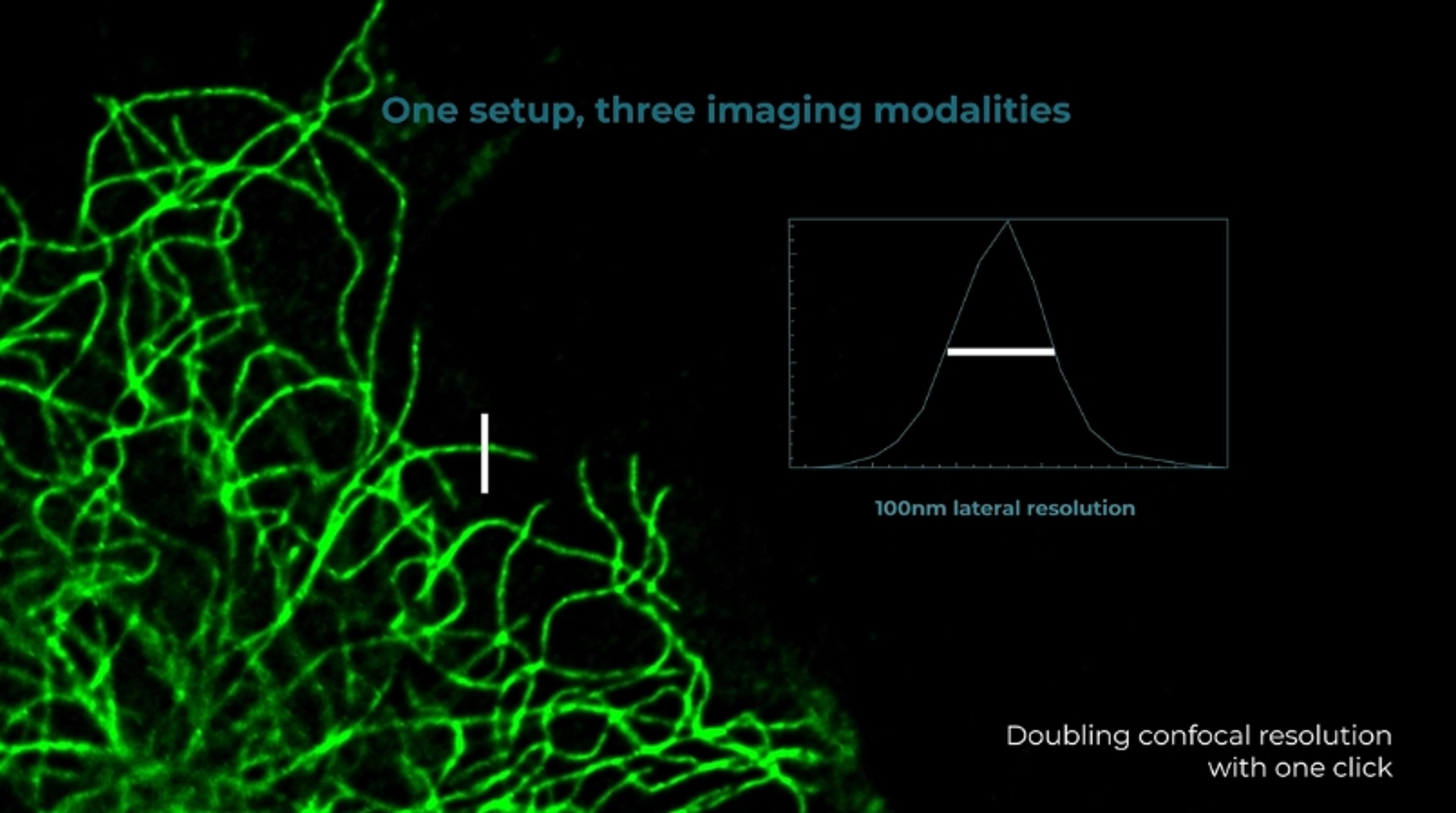 CrestOptics DeepSIM super-resolution system CrestOptics DeepSIM super-resolution system