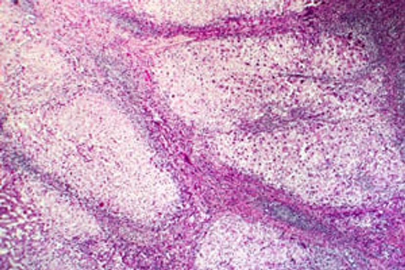 Tips and tricks to lower the costs of diagnostic histopathology