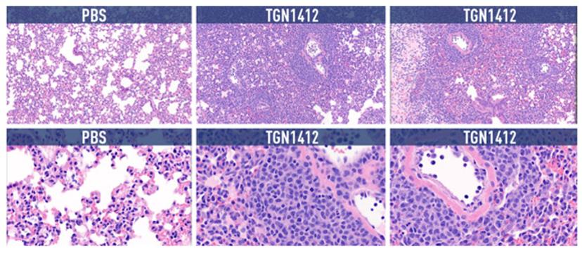 Studying complex, systemic immune responses in humanized mice