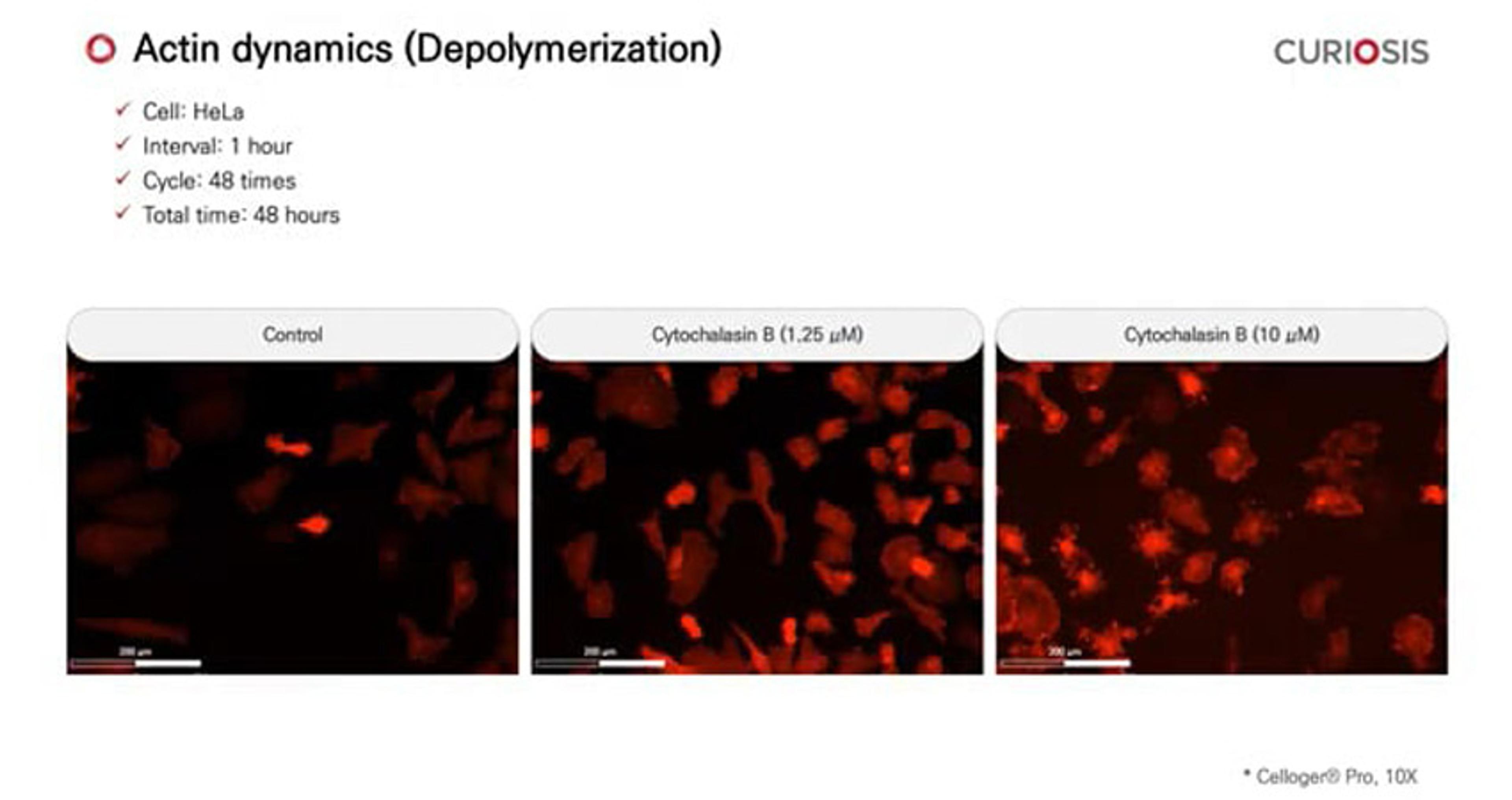 Celloger Pro application: Actin dynamics Celloger Pro application: Actin dynamics