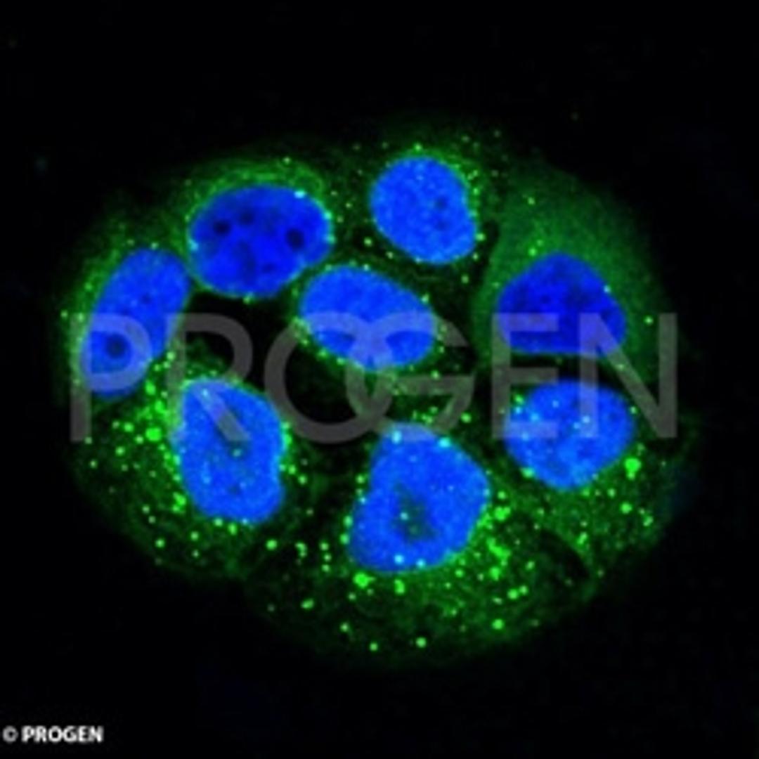 human PLC cells