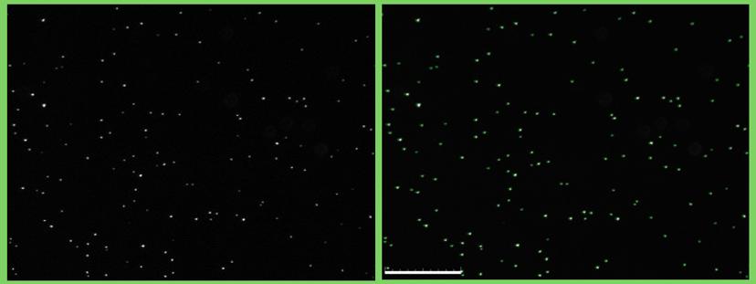 Fluorescent cells visualized using the QUANTOM Tx Dr. Dennis Nurjadi