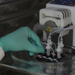 Organ-on-chip perfusion set-up