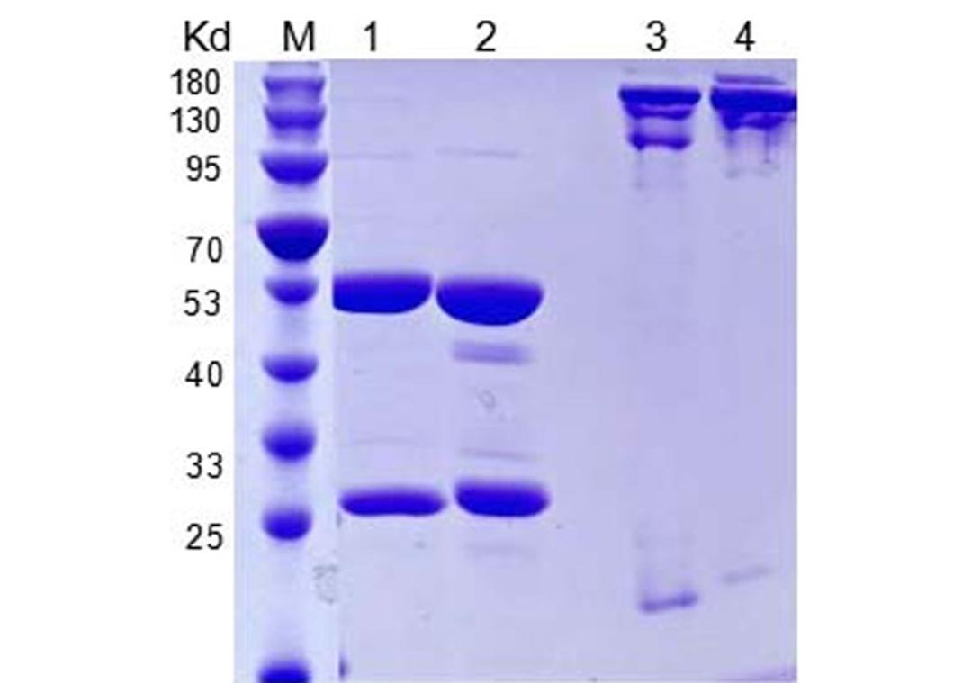Anti-Human IL5 Recombinant Antibody (TAB-031)