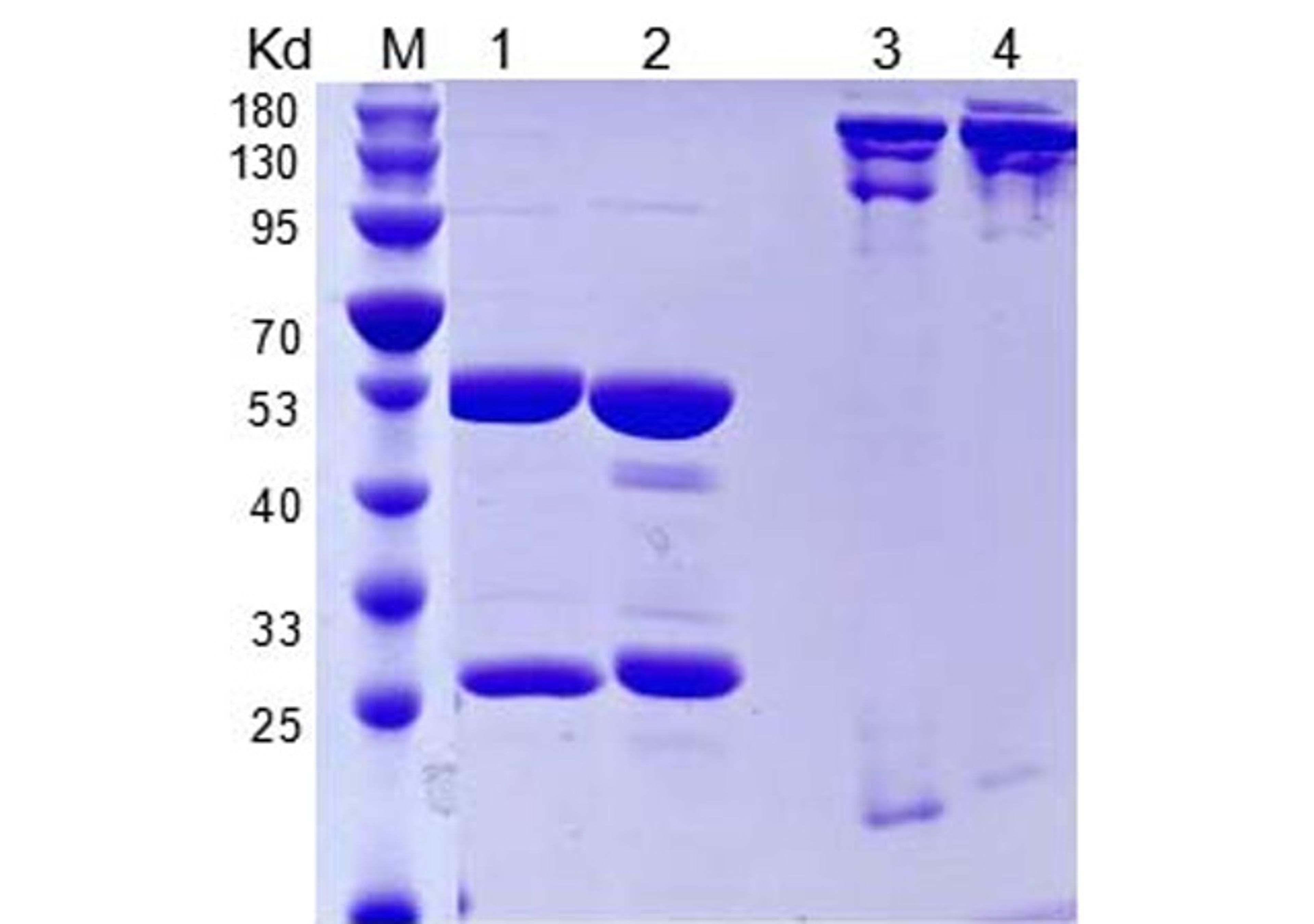 Anti-Human IL5 Recombinant Antibody (TAB-031)