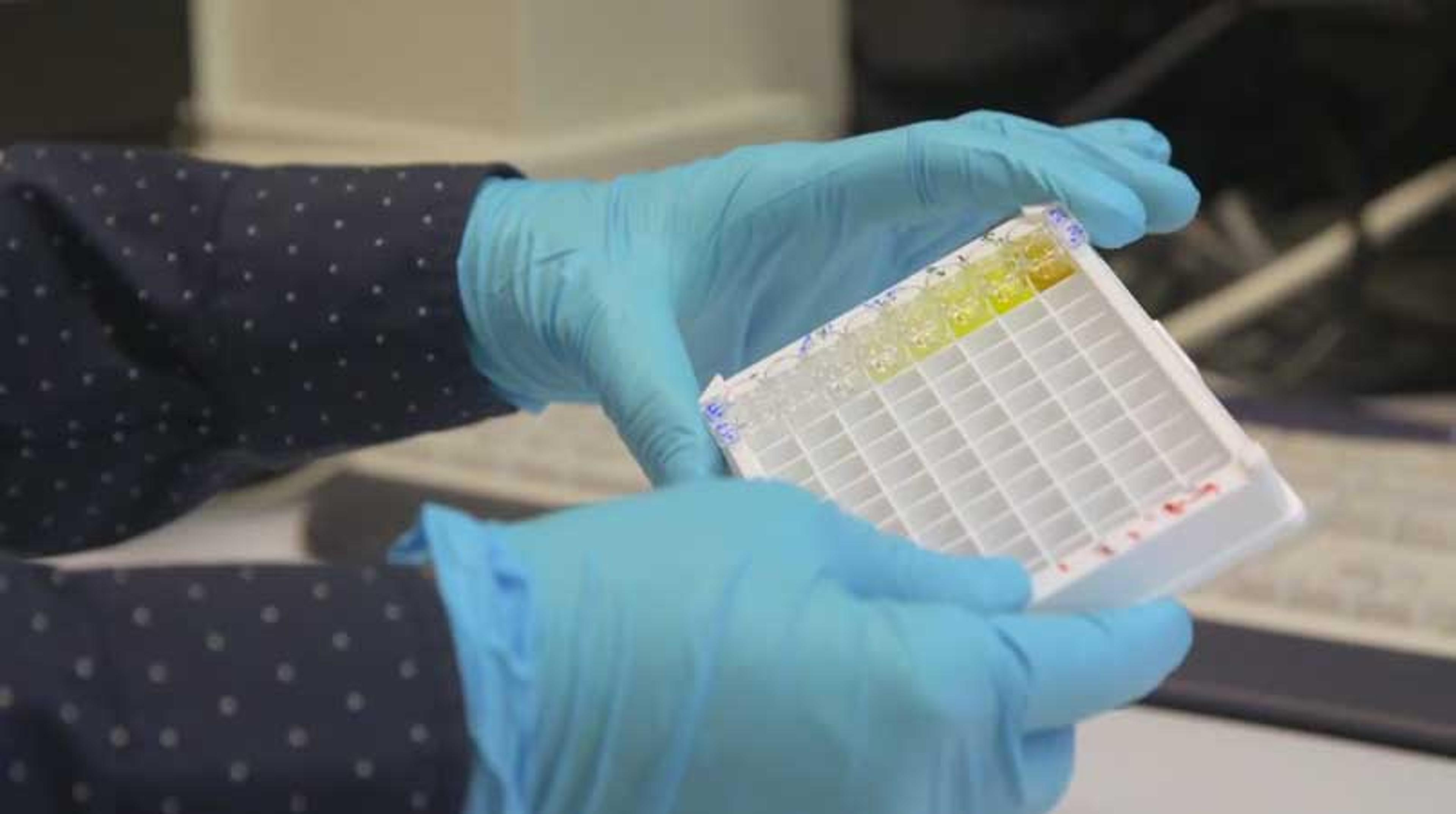 Detecting Bioterrorism Threats Using an Enzyme-Linked Oligonucleotide Assay Approach Detecting Bioterrorism Threats Using an Enzyme-Linked Oligonucleotide Assay Approach