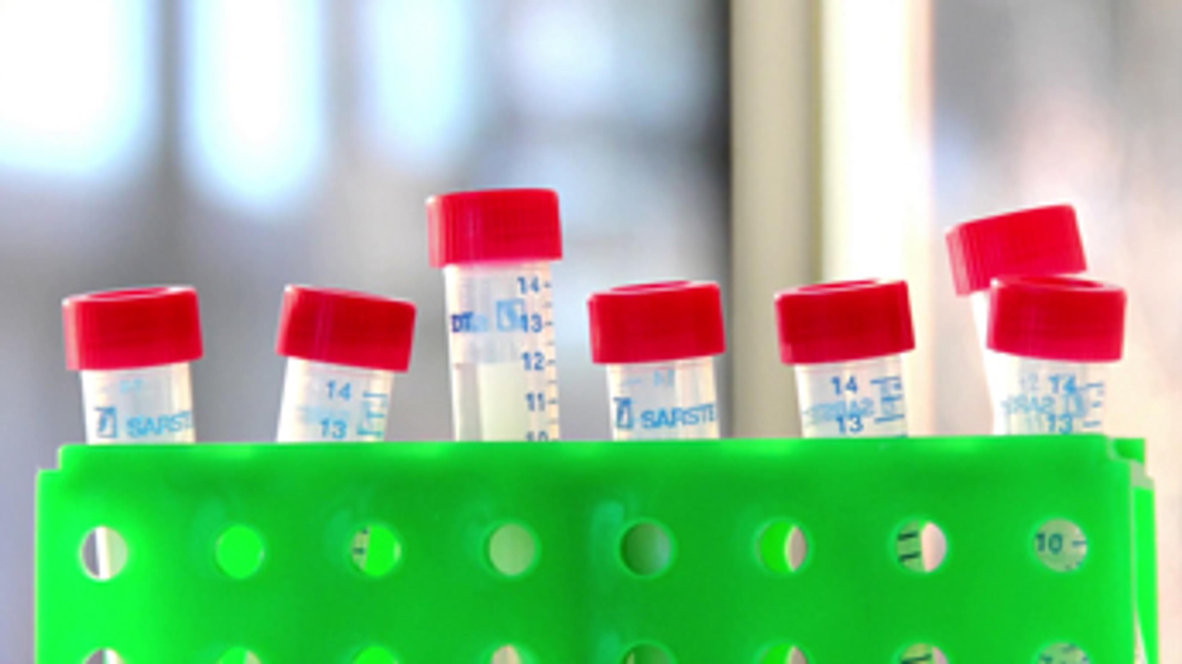 High Quality ChIP-seq Experiments with Diagenode Automation Instruments High Quality ChIP-seq Experiments with Diagenode Automation Instruments