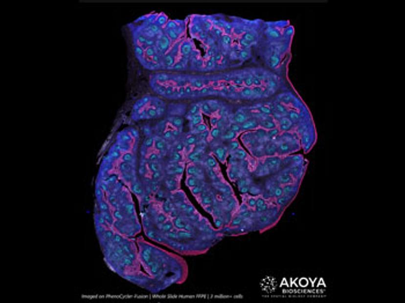 A whole slide human FFPE sample with more than 3 million cells, imaged on the PhenoCycler-Fusion