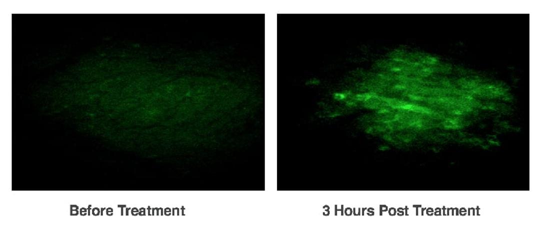 IN vivo detection of apoptosis in a mouse tumor model