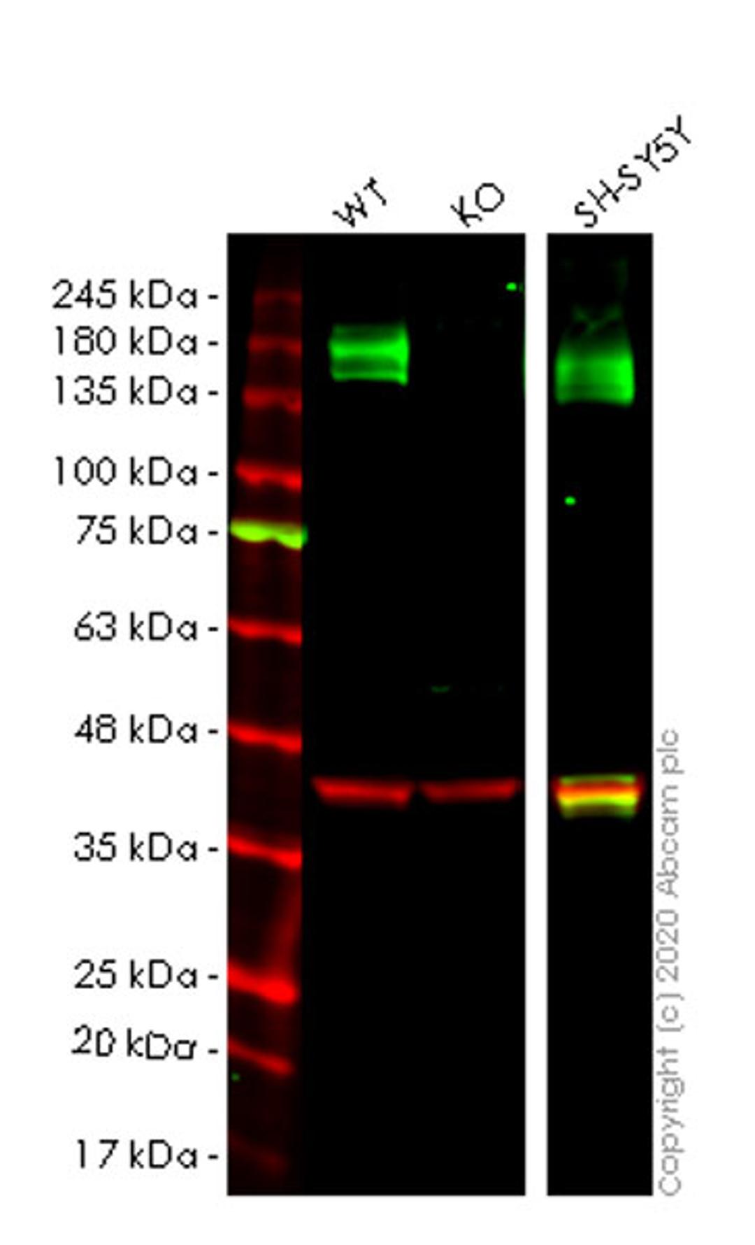 WB - ATP2B4 knockout HeLa