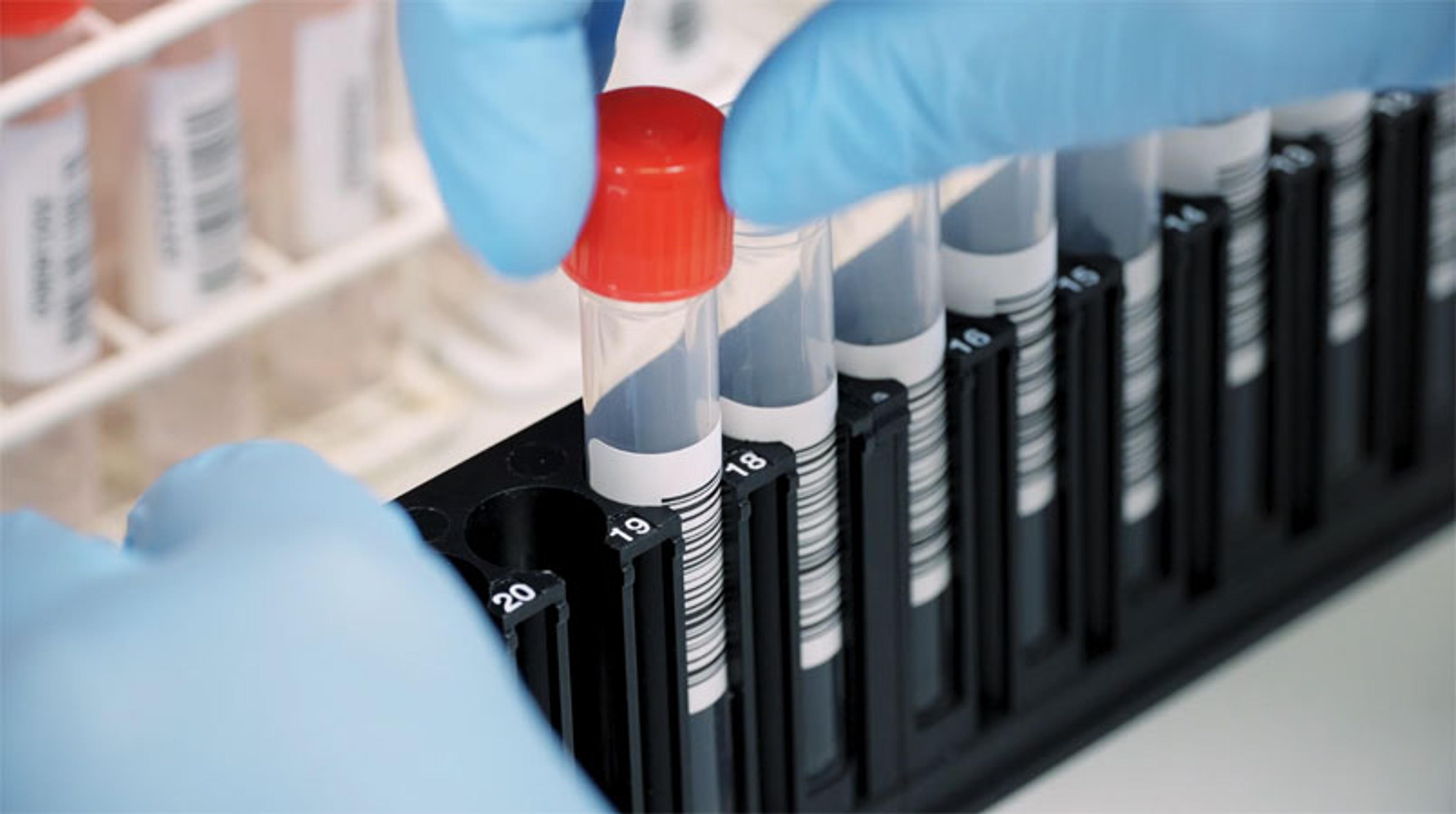 Overcoming bottlenecks in RNA preparation Overcoming bottlenecks in RNA preparation