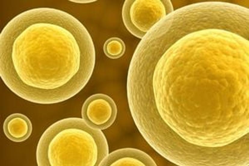Modeling the tumor microenvironment: An <em>in vitro</em> T cell exhaustion model for the characterisation of multi-specific biologics and immunotherapies