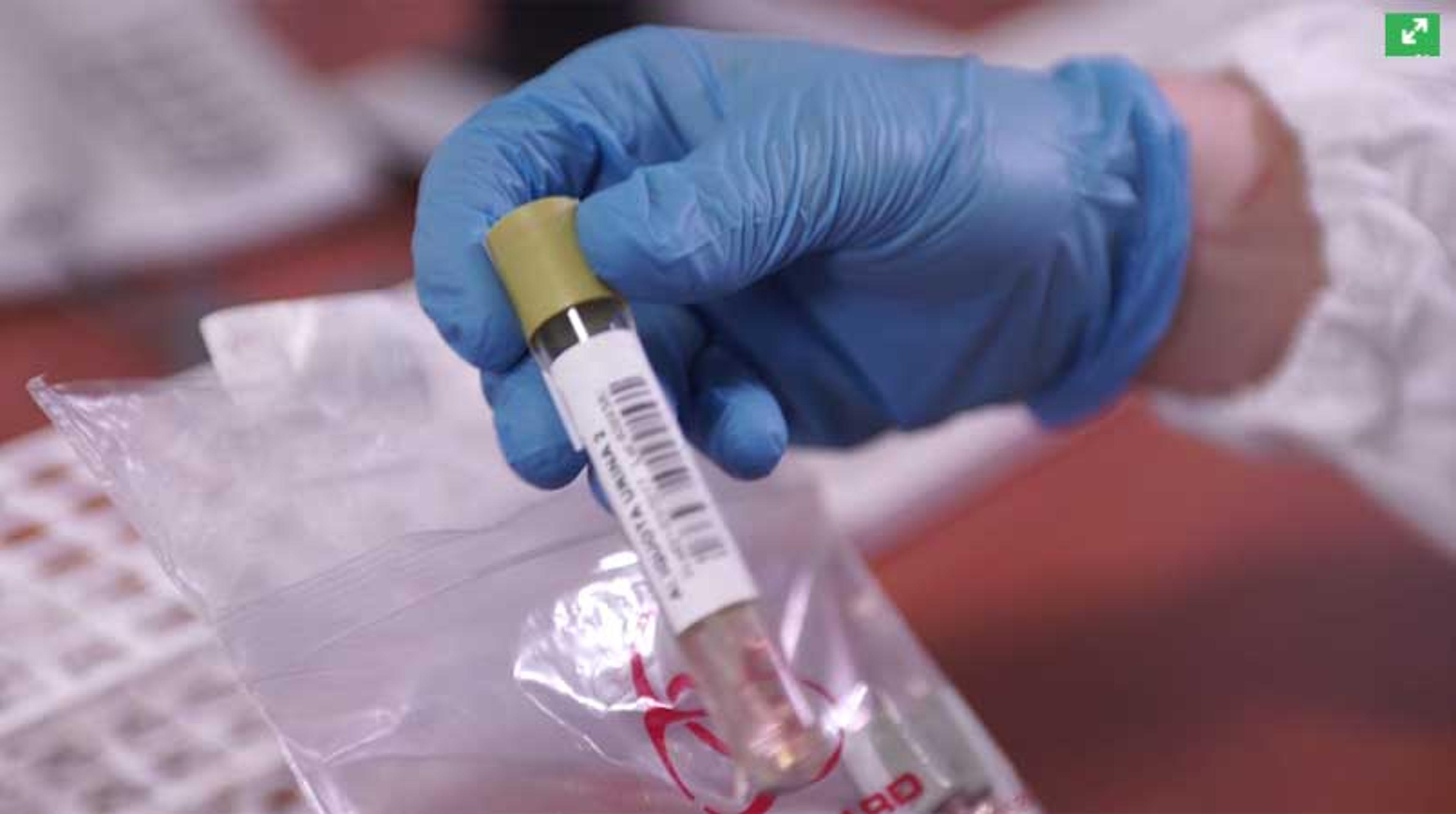 Hidden Potential of Mass Spectrometry Over Immunoassay Solutions Hidden Potential of Mass Spectrometry Over Immunoassay Solutions
