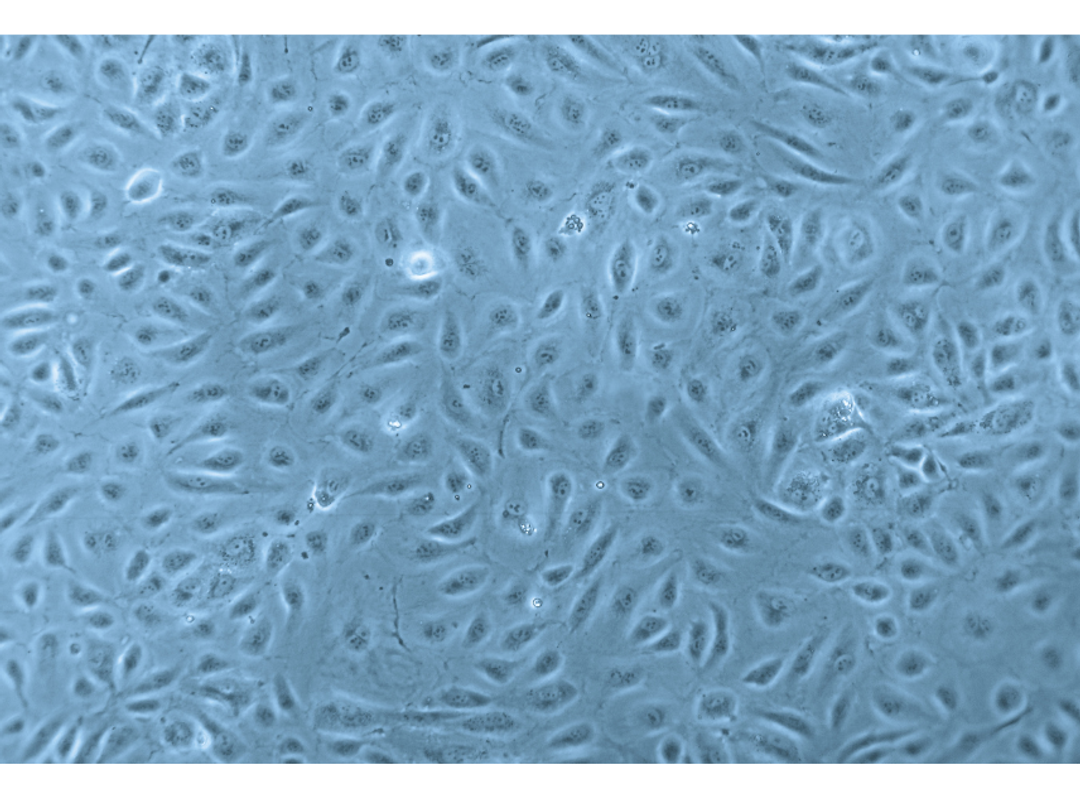 Human Endothelial Cells