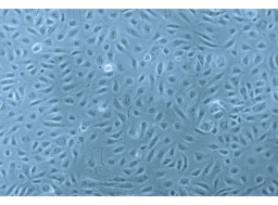 Human Endothelial Cells