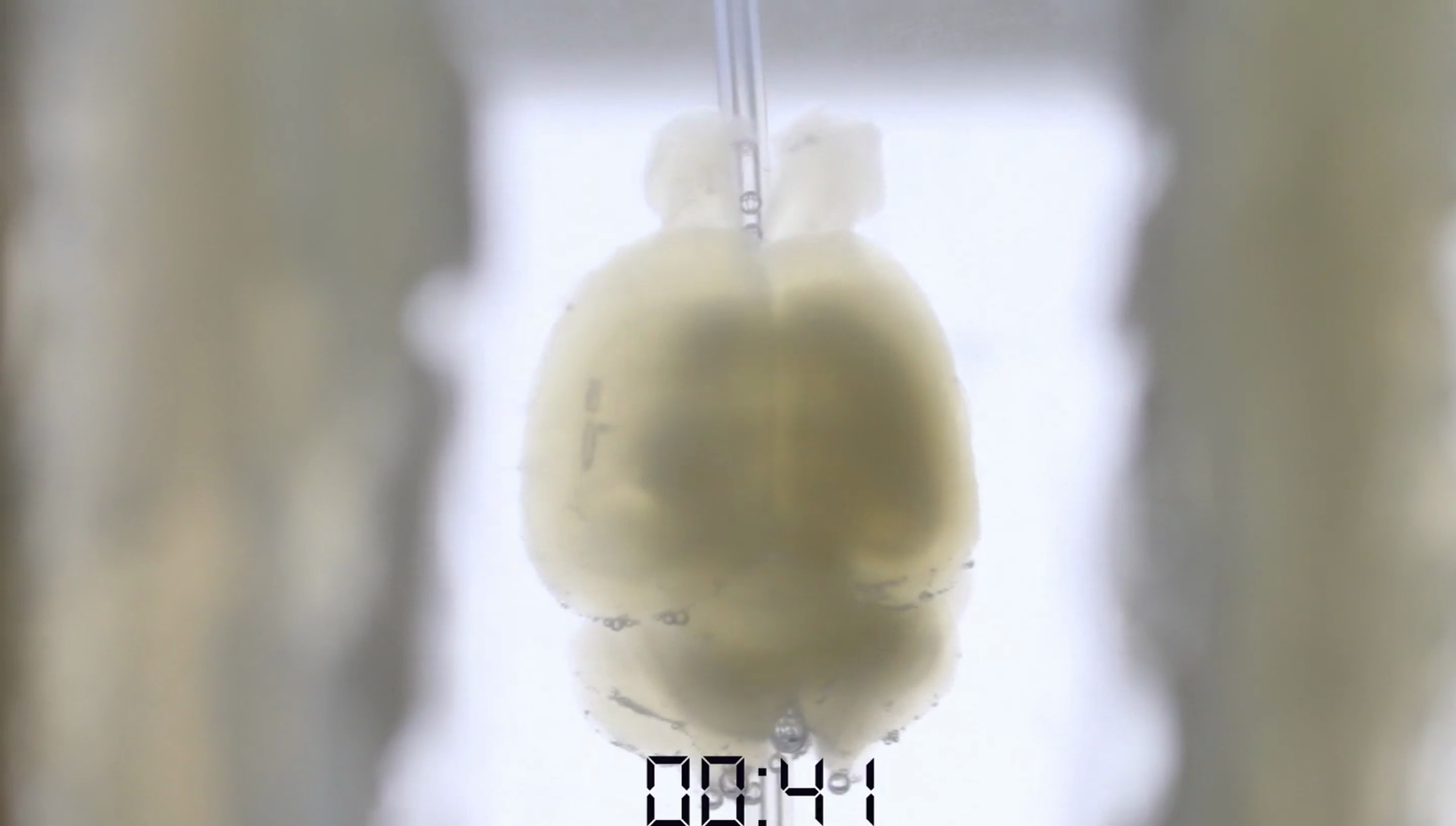 Time Lapse Video of a Mouse Brain Being Cleared Time Lapse Video of a Mouse Brain Being Cleared