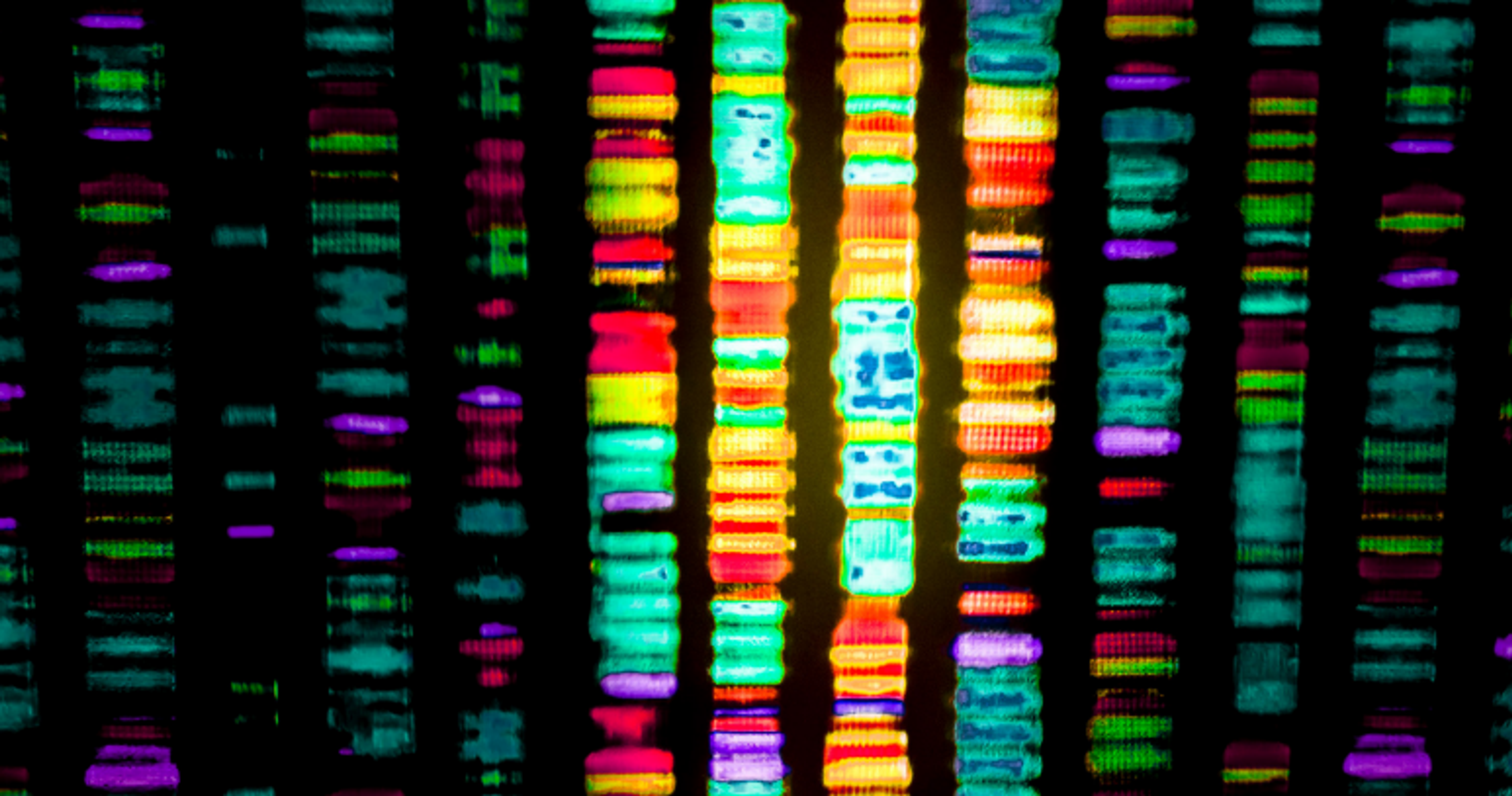 How to Buy Oligonucleotide Purification and Quantification Technology