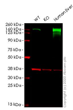 WB - CPS1 knockout HeLa