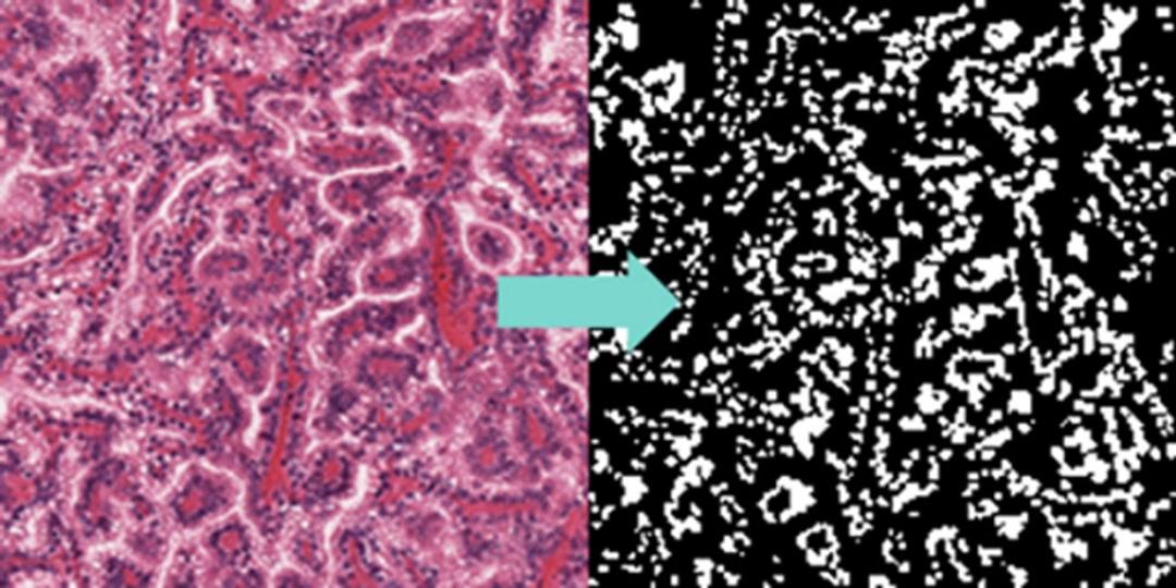 Before/after sample of nuclei segmentation workflow