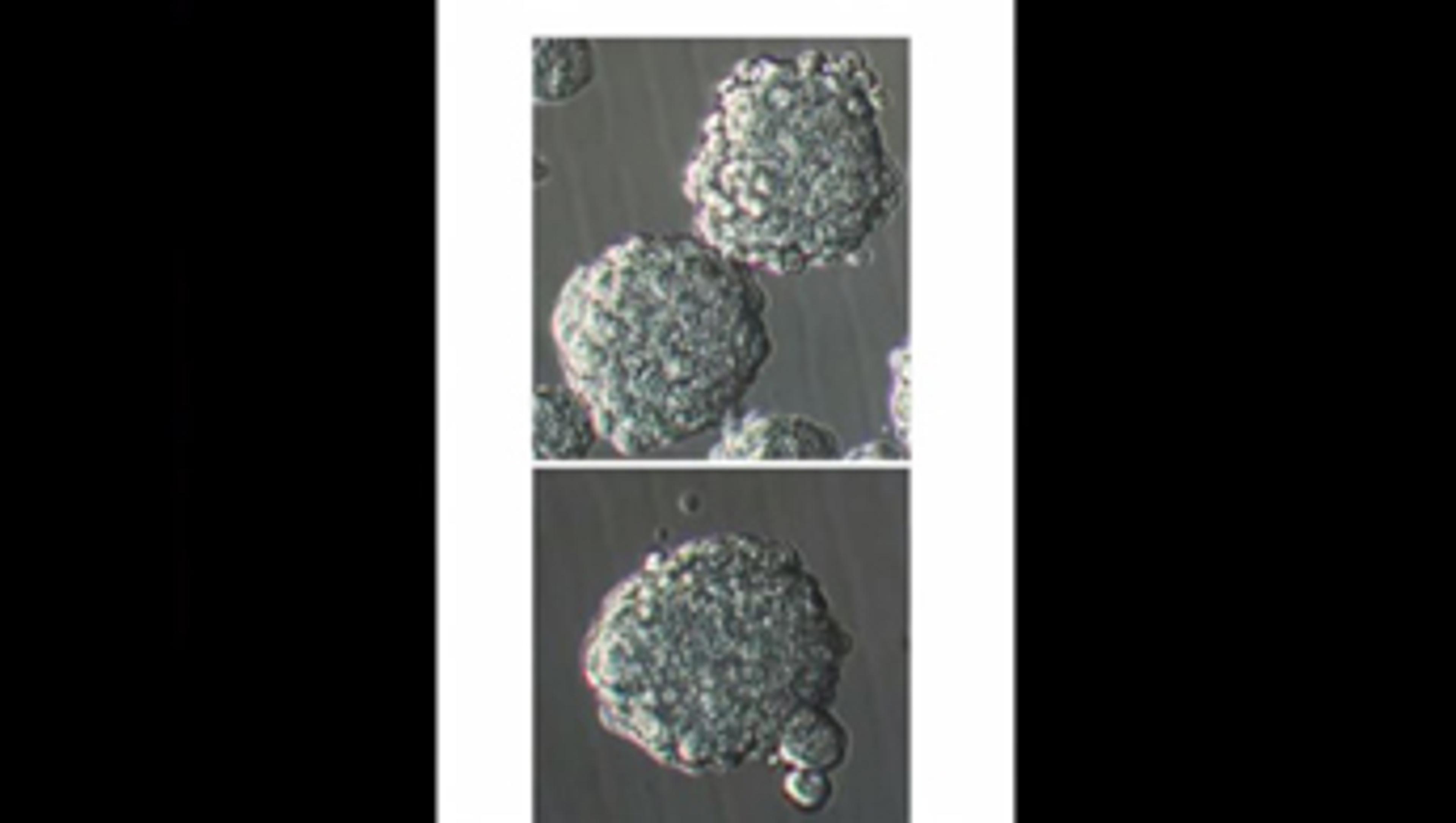 Isolation and Expansion of Human Glioblastoma Multiforme Cells Using the Neurosphere Assay Isolation and Expansion of Human Glioblastoma Multiforme Cells Using the Neurosphere Assay