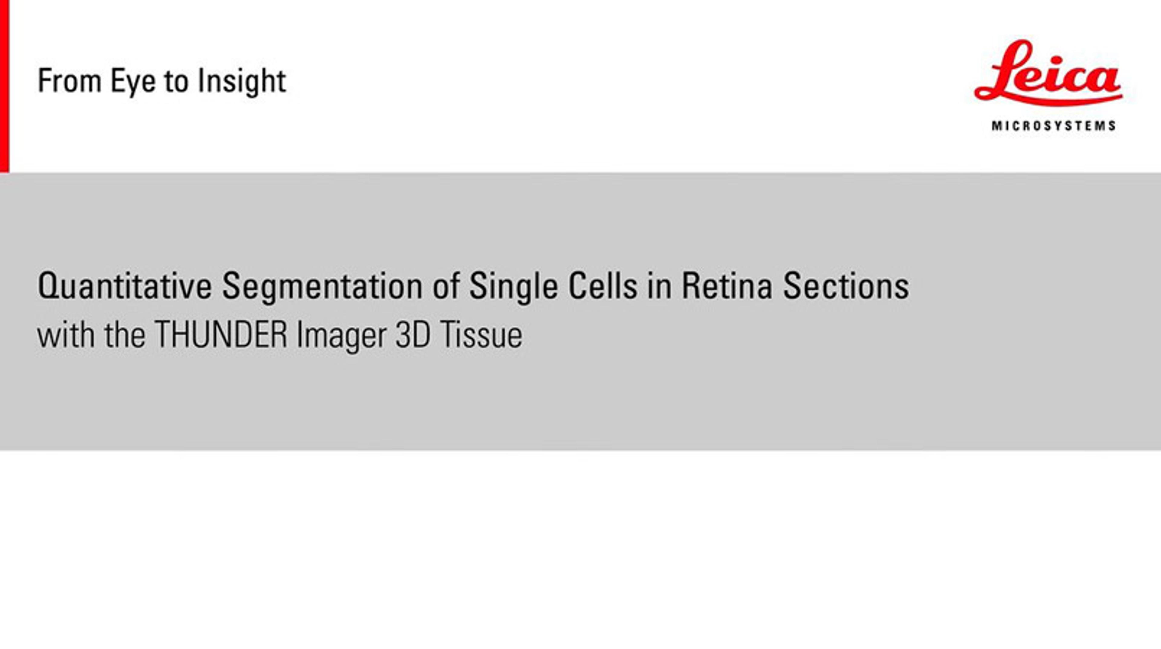 Quantitative segmentation of single cells in retina sections with the THUNDER Imager 3D Tissue Quantitative segmentation of single cells in retina sections with the THUNDER Imager 3D Tissue