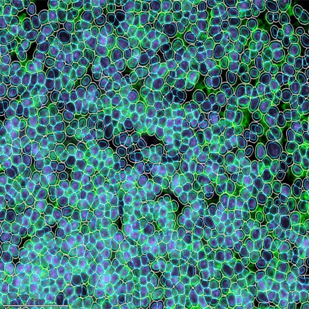 Nuclei Segmentation & cell approximation