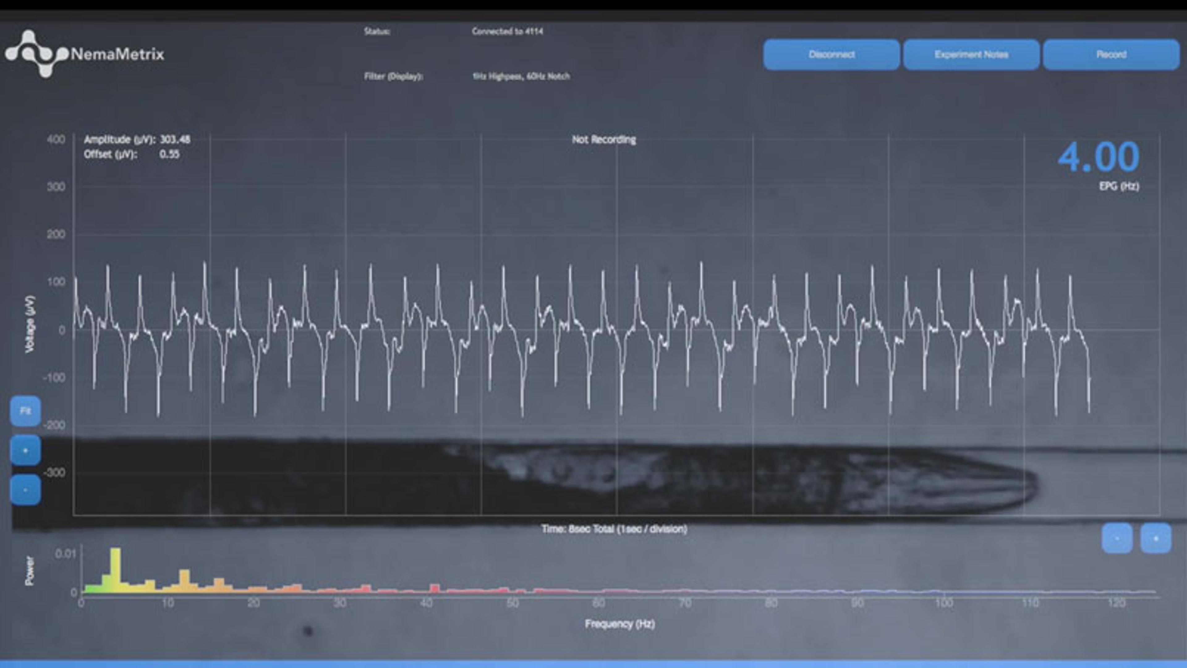 Recording C. elegans Pharyngeal Pumps Recording C. elegans Pharyngeal Pumps