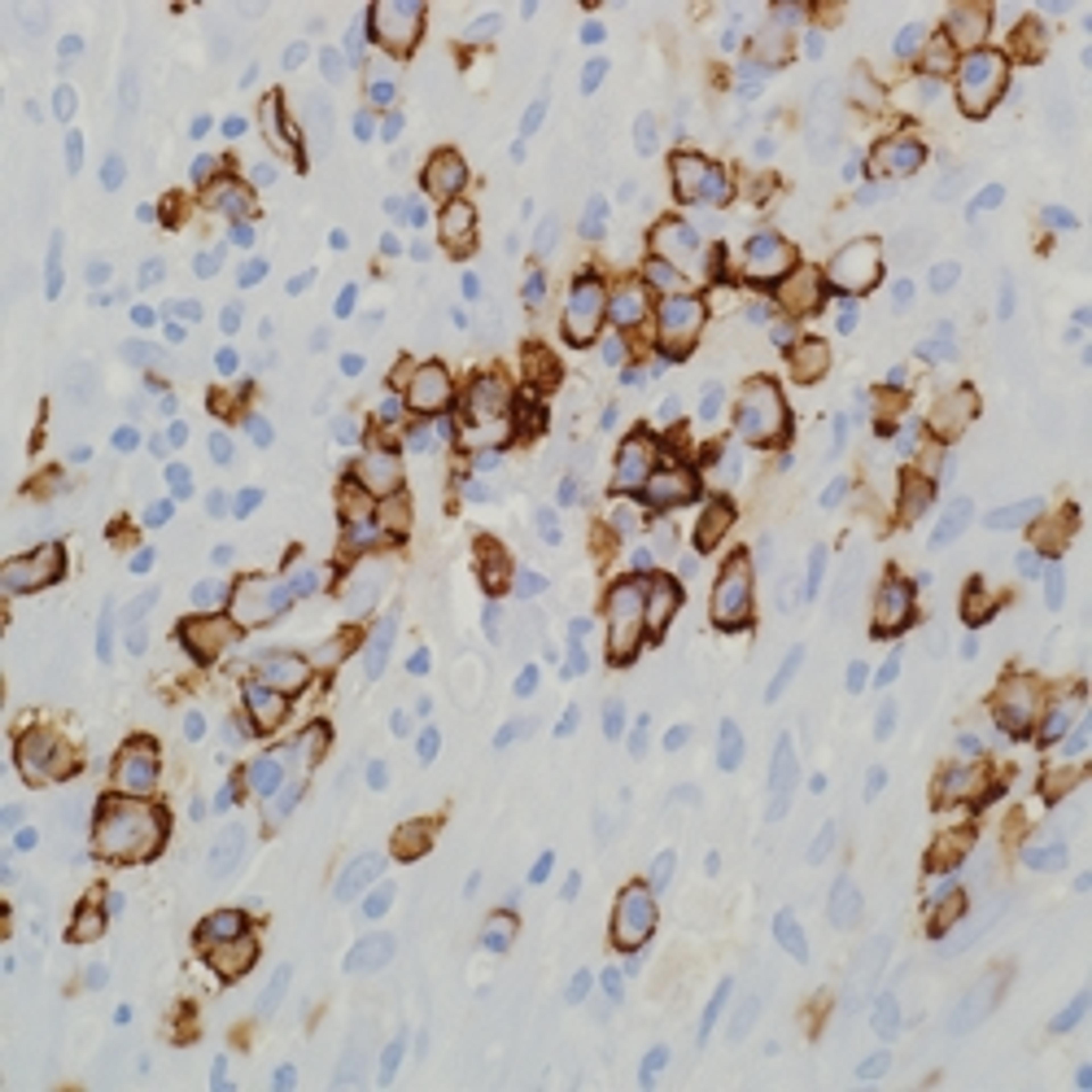 CD138/syndecan-1 (B-A38) on plasma cells.