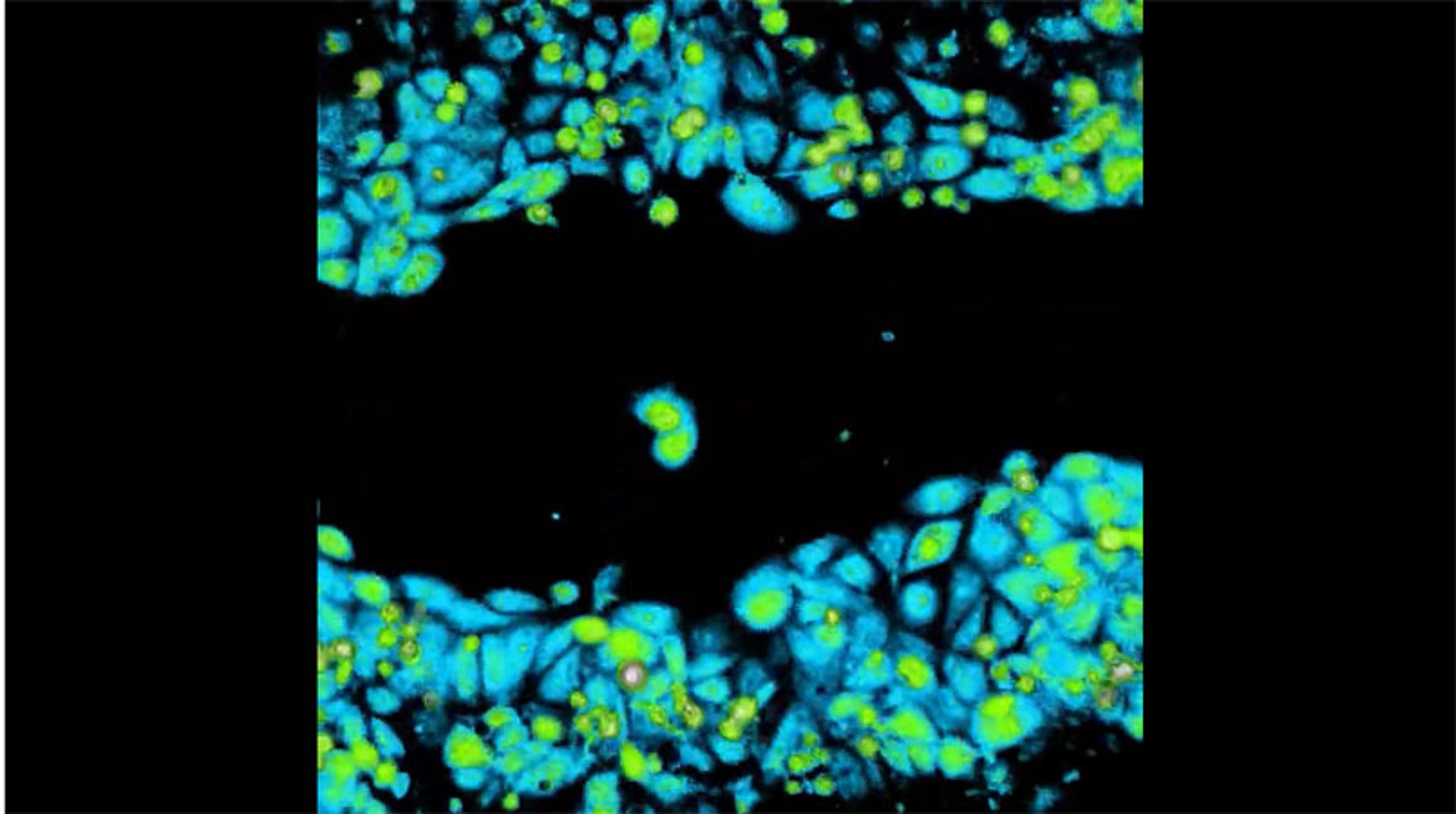 Live-cell imaging: Wound healing assay with JIMT-1 breast cancer cells Live-cell imaging: Wound healing assay with JIMT-1 breast cancer cells