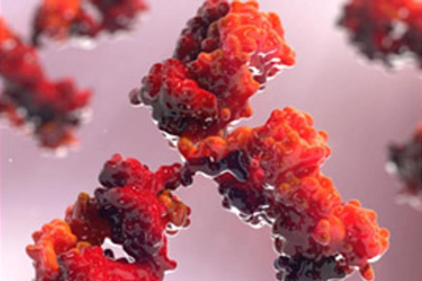 Best practices for choosing antibodies and achieving reliable results