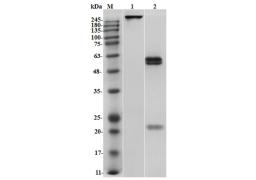 Mouse Anti-DOTA Recombinant Antibody (HPAB-1251WJ)