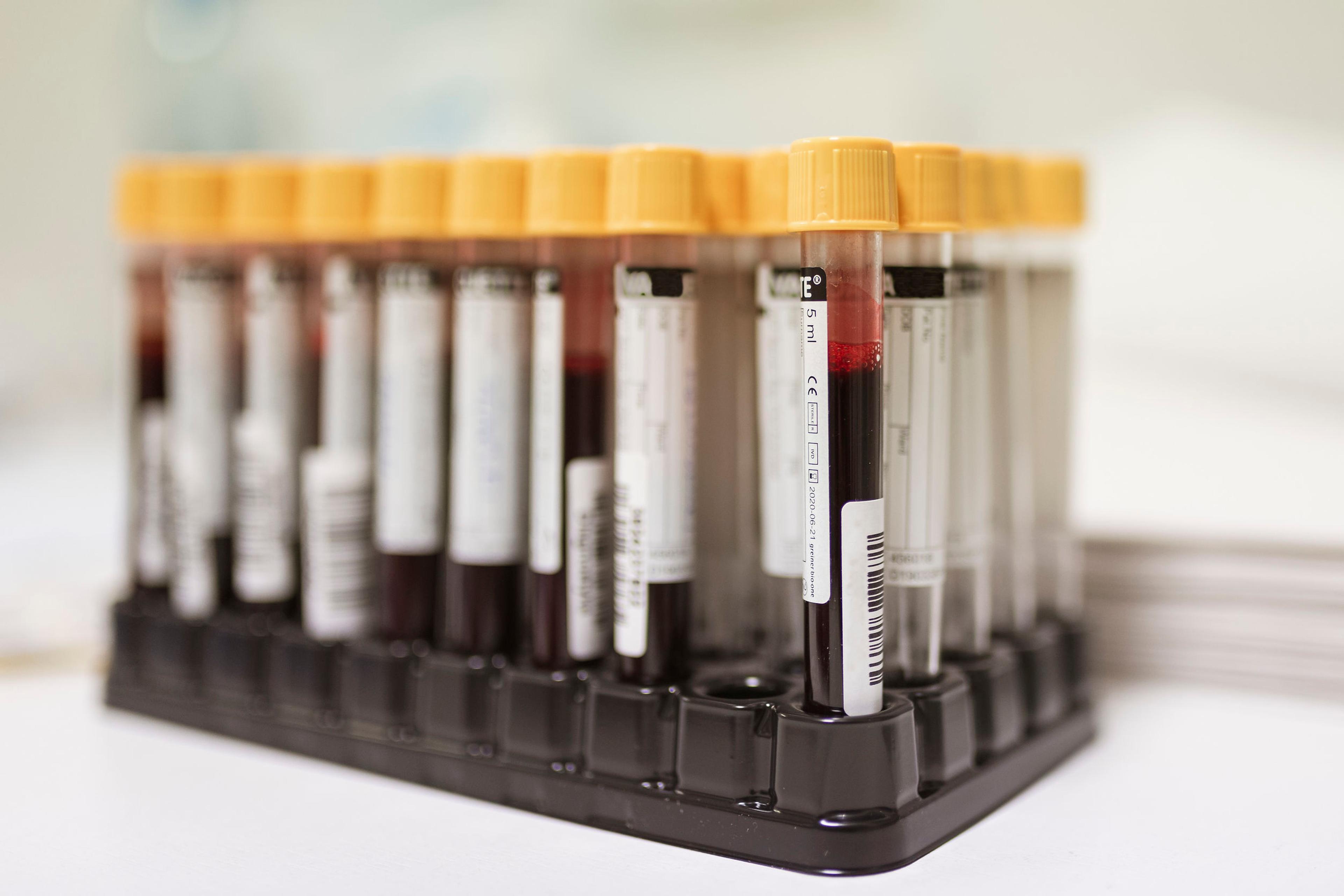 serum samples used for clinical mass spectrometry