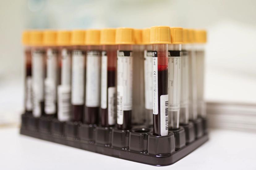 SST samples for clinical mass spectrometry