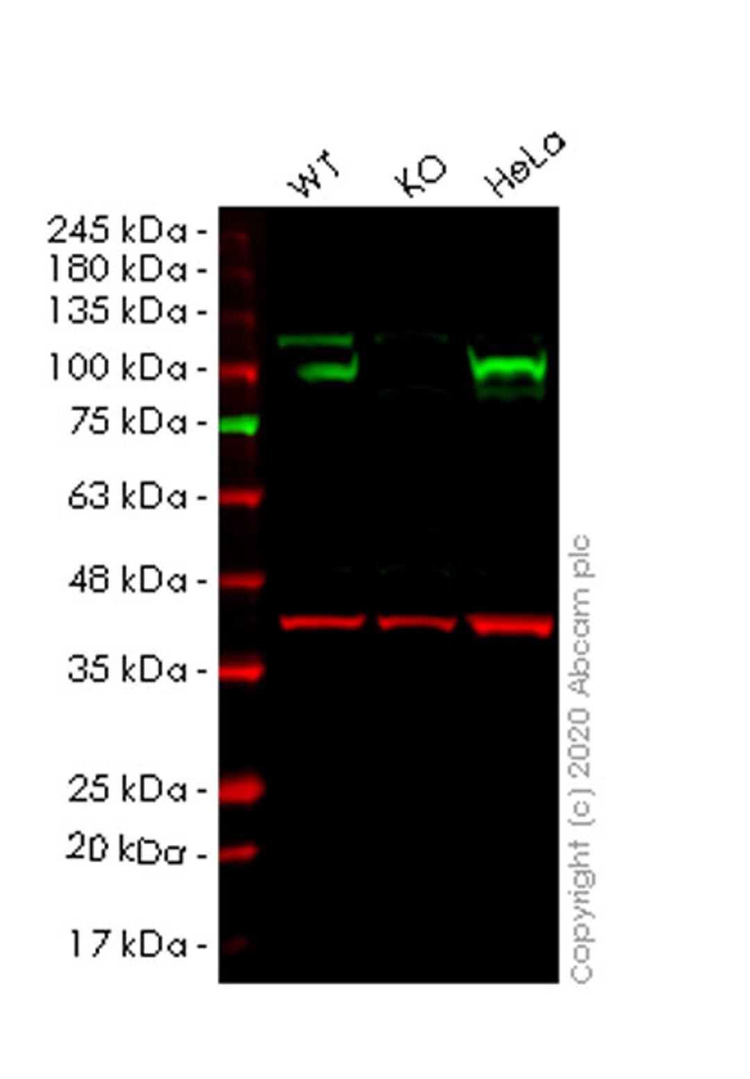 WB - HSP90B1 knockout HEK293T