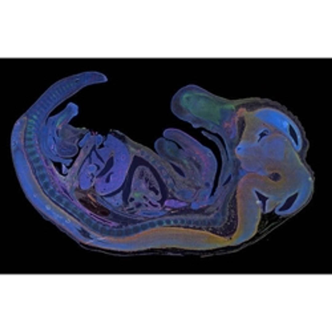 Multichannel fluorescence mouse embryo acquired by tiling mu