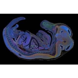 Multichannel fluorescence mouse embryo acquired by tiling mu