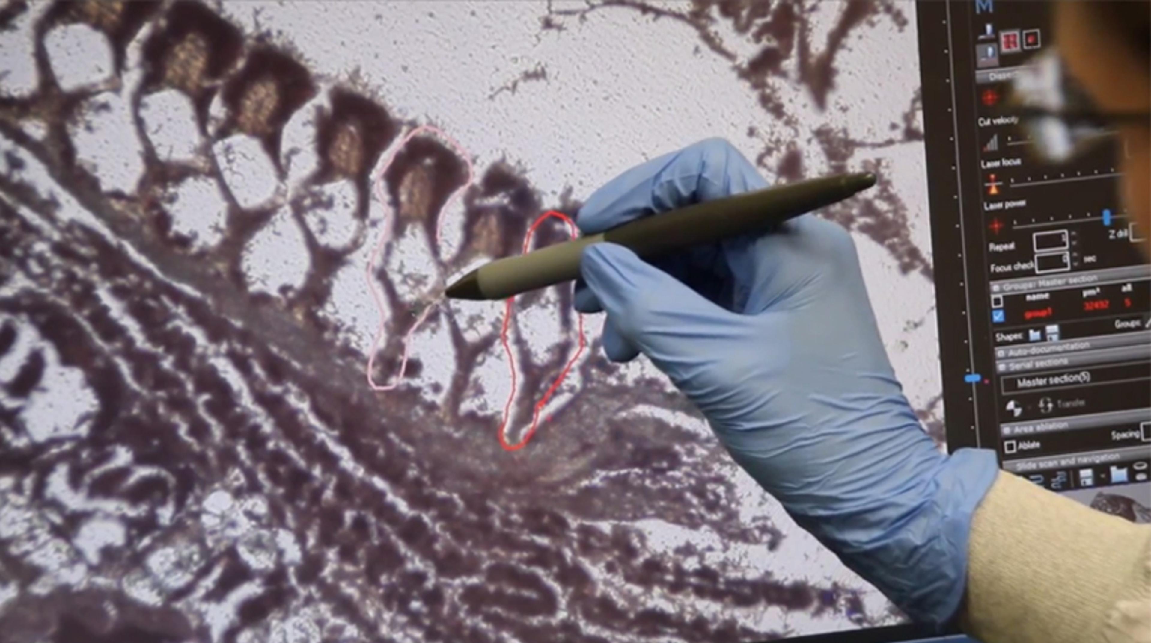 MMI CellCut: Clear-cut Laser Microdissection MMI CellCut: Clear-cut Laser Microdissection