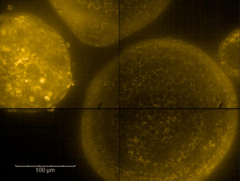 Patient-derived tumor organoids