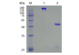Human Anti-CRCP Recombinant Antibody (TAB-426CQ)
