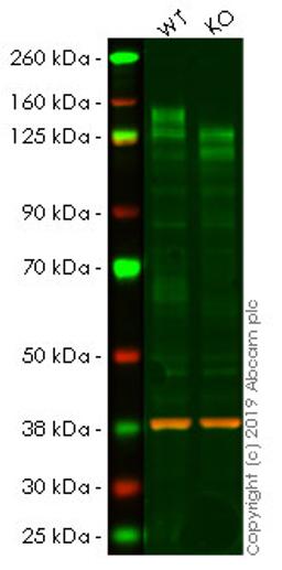 WB - IL6ST knockout HeLa