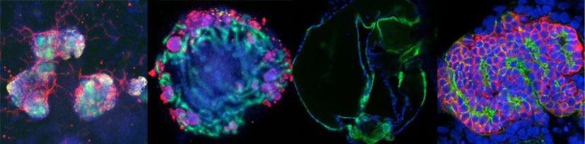 Kidney Organoids in the Freedman lab