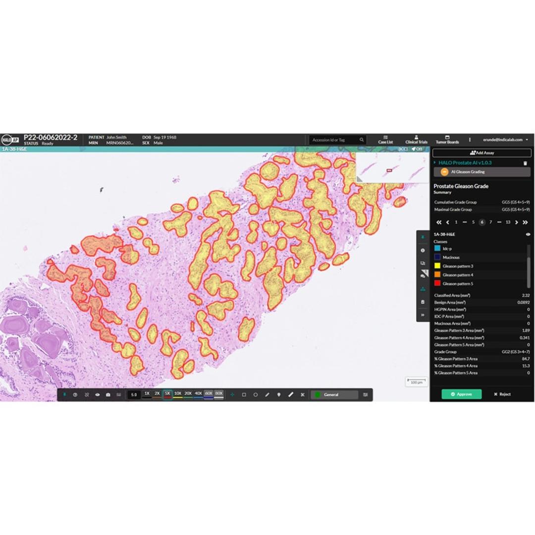 HALO Prostate AI - null - Clinical Diagnostics