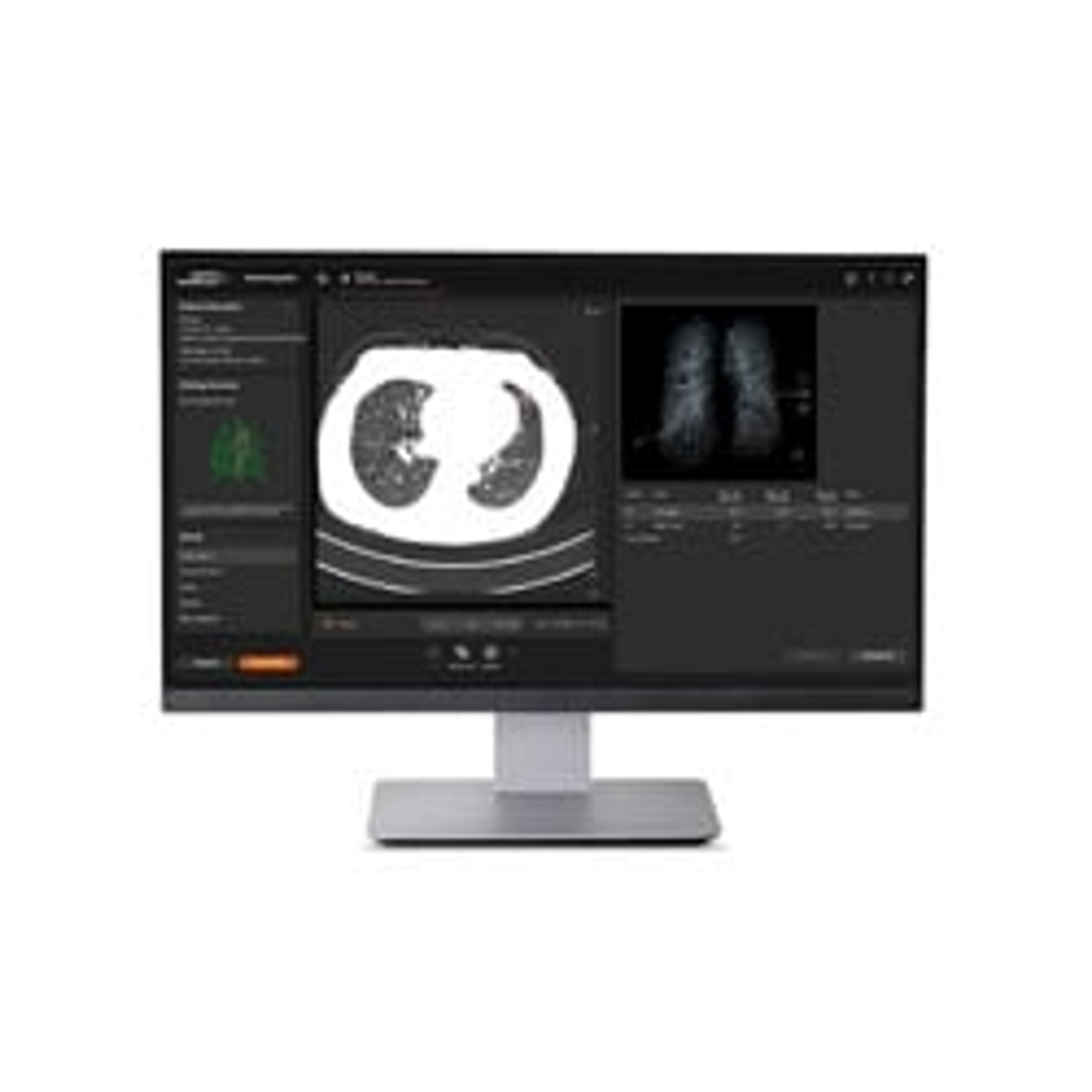 AI-Rad Companion - Siemens Healthineers - Clinical Diagnostics