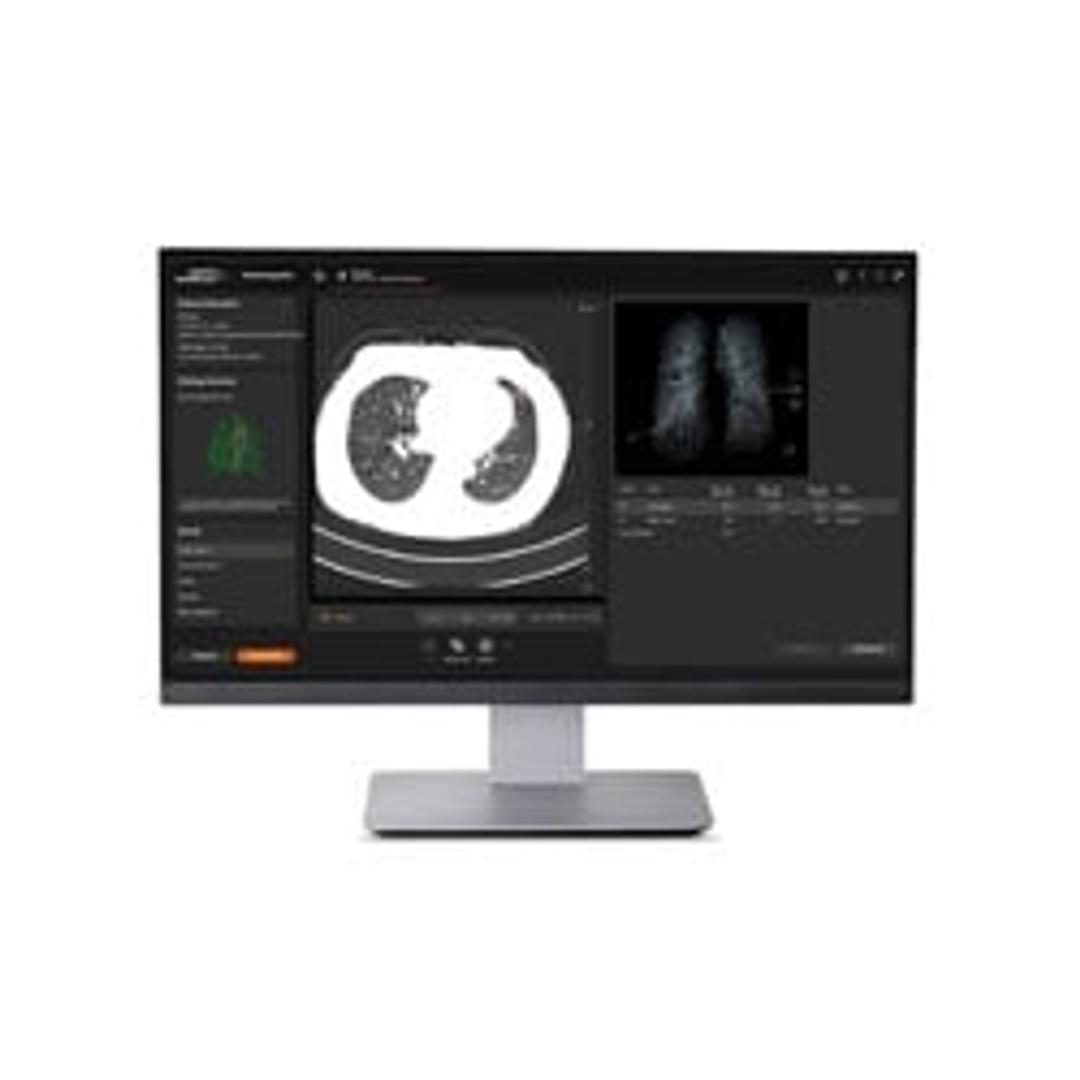 AI-Rad Companion - Siemens Healthineers - Clinical Diagnostics