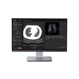 AI-Rad Companion - Siemens Healthineers - Clinical Diagnostics