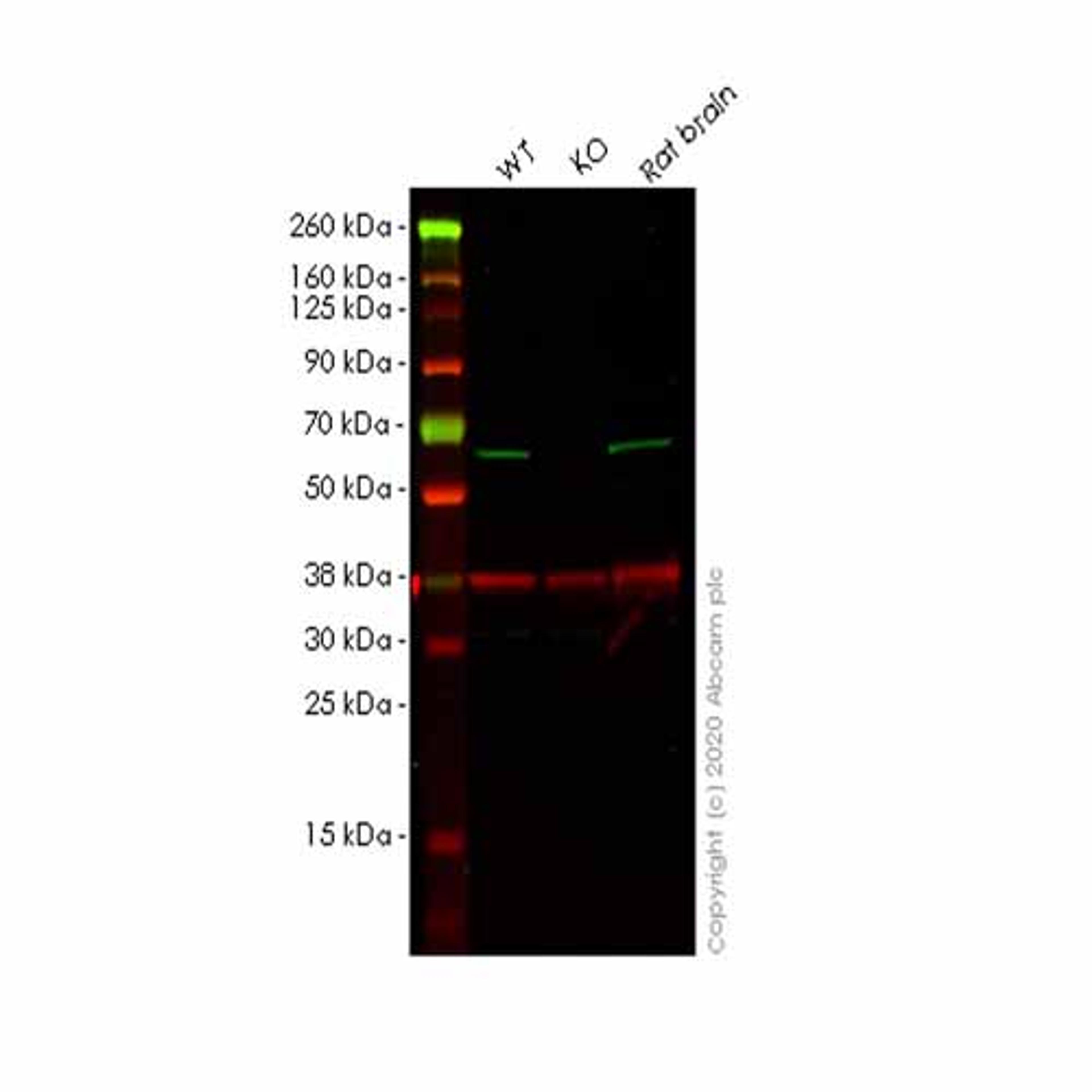 Human SPAST (Spastin) knockout HEK293T cell line - Abcam plc - Life Sciences