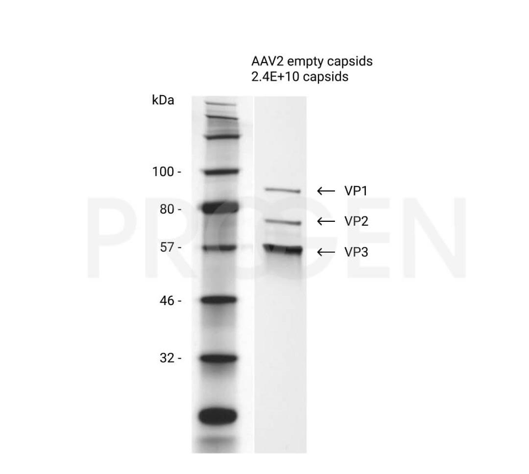 AAV2 empty capsids - PROGEN - Life Sciences