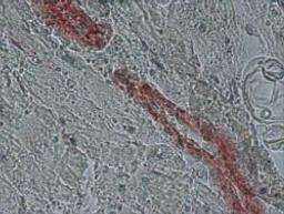 Anti-β-Actin antibody, Mouse monoclonal - Merck KGaA, Darmstadt, Germany - Life Sciences