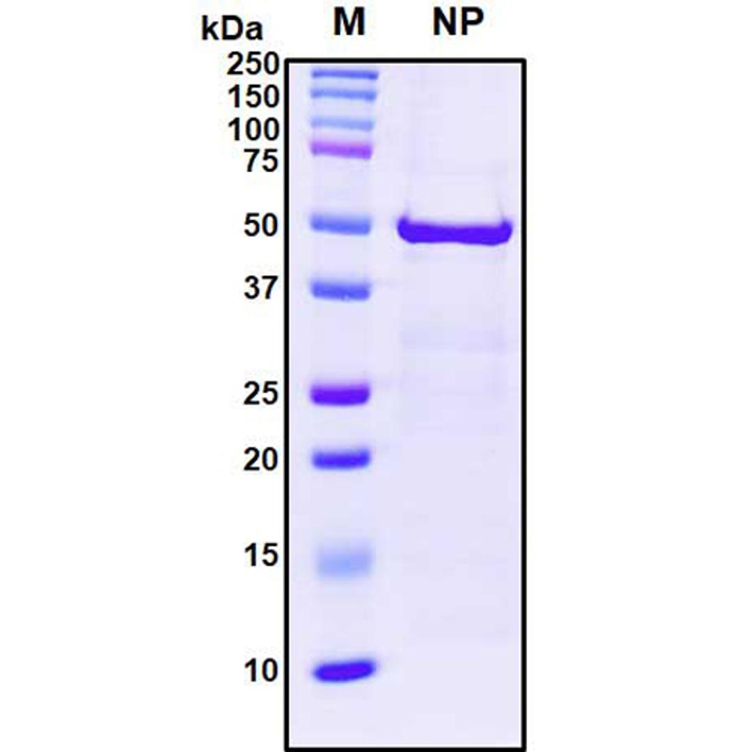 Recombinant SARS-CoV-2 Nucleocapsid Protein - RayBiotech Inc. - Life Sciences